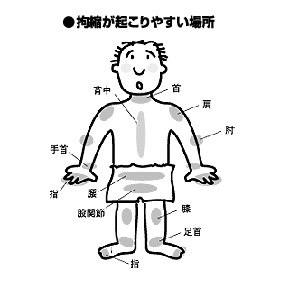 在宅医療マッサージとは