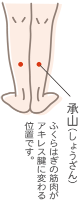 足がつる「こむら返り」の予防と対策